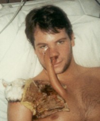 Recovering from Surgery - October, 1985